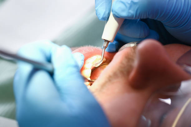 Best Urgent Dental Care for Toothache in Fairbank, IA
