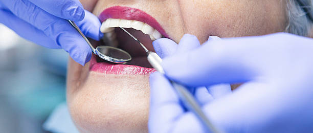 Best Emergency Dentist for Lost Fillings or Crowns in Fairbank, IA