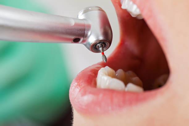 Best Emergency Dental Services for Seniors in Fairbank, IA